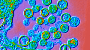 What is hantavirus